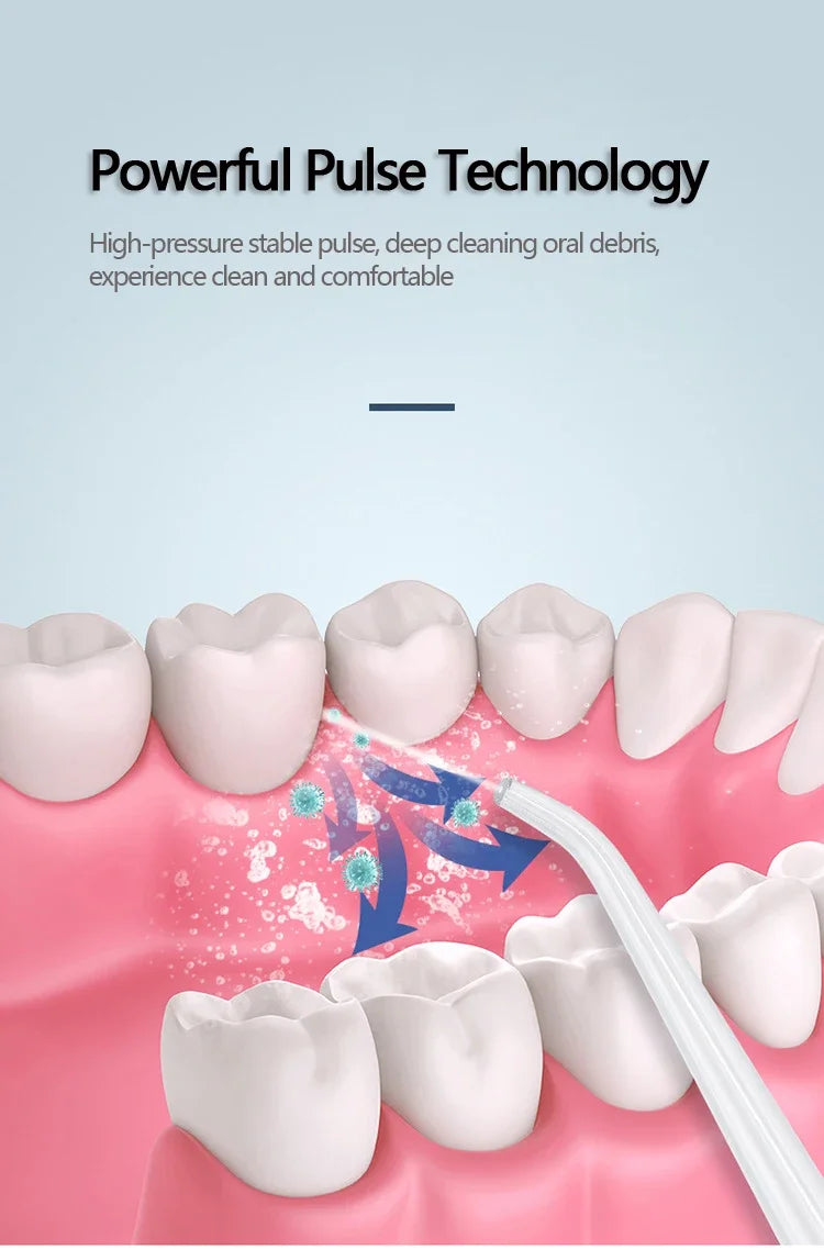 Portable Oral Irrigator Water Flosser | Dental Water Jet for Deep Teeth Cleaning & Gum Care
