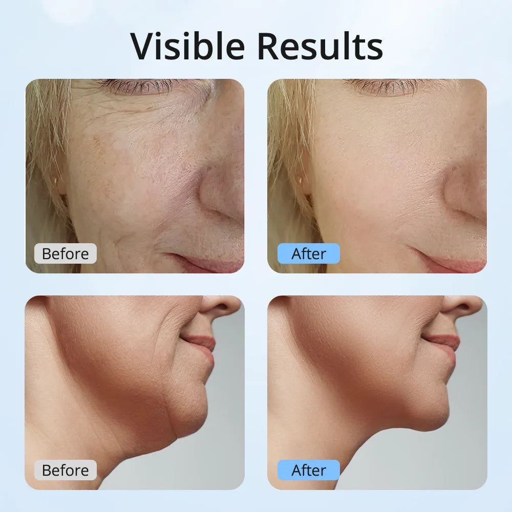 Facial Lifting Device Neck Face Eye Massage Face Slimming EMS Beauty Skin Phototherapy Machine Anti Aging Reduce Double Chin